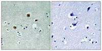 PAKβ Polyclonal Antibody