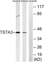 FX Polyclonal Antibody