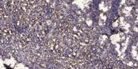 Rho D Polyclonal Antibody