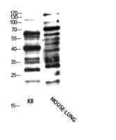 Pan glycine myristoylation  Polyclonal Antibody