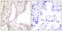 PAR4 Polyclonal Antibody