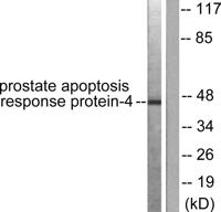 PAR4 Polyclonal Antibody