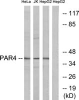 PAR-4 Polyclonal Antibody