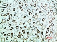 Parathyroid hormone/parathyroid hormone-related peptide receptor Polyclonal Antibody