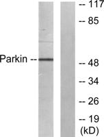 PARK2 Polyclonal Antibody