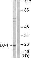 PARK7 Polyclonal Antibody