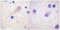 Parkin Polyclonal Antibody