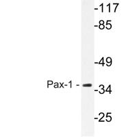 Pax-1 Polyclonal Antibody