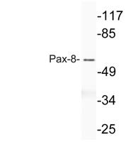 Pax-8 Polyclonal Antibody