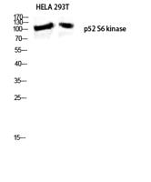 p52 S6 kinase Polyclonal Antibody