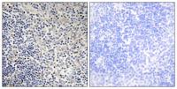 p53AIP1 Polyclonal Antibody