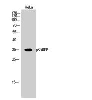 p53RFP Polyclonal Antibody