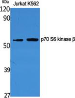 p70 S6 kinase β Polyclonal Antibody