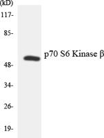 p70 S6 kinase β Polyclonal Antibody