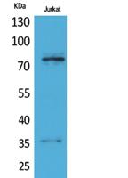 p73 Polyclonal Antibody