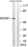 PA26 Polyclonal Antibody