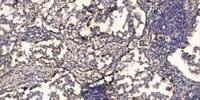 PABP5 Polyclonal Antibody