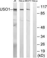 p115 Polyclonal Antibody