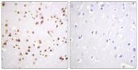 p120 Polyclonal Antibody