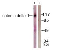 p120 Polyclonal Antibody