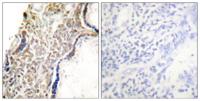 p14ARF Polyclonal Antibody