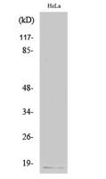 p16 INK4A Polyclonal Antibody