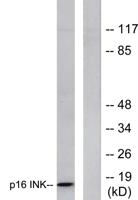 p16 INK4A Polyclonal Antibody