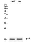 p16 Polyclonal Antibody