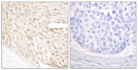 p18 Polyclonal Antibody