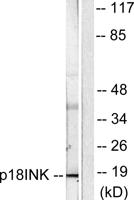 p18 Polyclonal Antibody