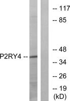 P2Y4 Polyclonal Antibody