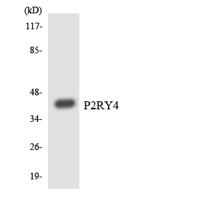 P2Y4 Polyclonal Antibody