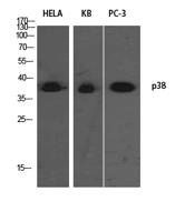 p38 Polyclonal Antibody