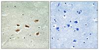 p39 Polyclonal Antibody