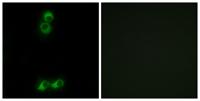 Olfactory receptor 10J5 Polyclonal Antibody