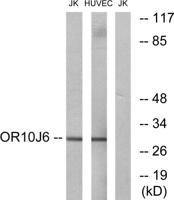 Olfactory receptor 10J6 Polyclonal Antibody