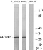 Olfactory receptor 10T2 Polyclonal Antibody