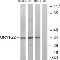 Olfactory receptor 11G2 Polyclonal Antibody