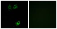 Olfactory receptor 11L1 Polyclonal Antibody