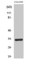 Olfactory receptor 1B1 Polyclonal Antibody