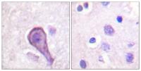 Rhodopsin Polyclonal Antibody