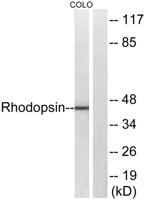 Rhodopsin Polyclonal Antibody