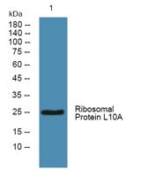 Ribosomal Protein L10A Polyclonal Antibody