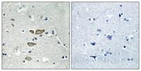 Ribosomal Protein L12 Polyclonal Antibody