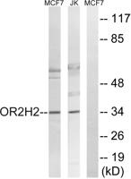 Olfactory receptor 2H2 Polyclonal Antibody