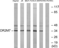 Olfactory receptor 2M7 Polyclonal Antibody