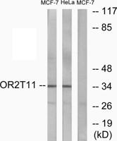 Olfactory receptor 2T11 Polyclonal Antibody