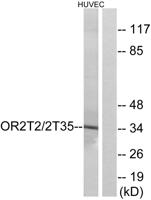 Olfactory receptor 2T2/35 Polyclonal Antibody