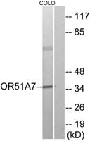 Olfactory receptor 51A7 Polyclonal Antibody