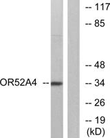 Olfactory receptor 52A4 Polyclonal Antibody